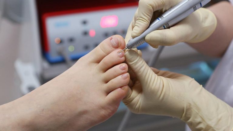 Foot Care Advocates: The Vital Role of Podiatrists in Preserving Mobility